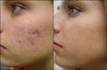 /album/maquillage-mary-kay/pqaaafgvsccxmq1ibfefnhfk7giec5fqlyle7-jobmb1jjtxwzuxsdkbrxt0cvcorlxmzxuyilqr-ywcj4mfsavc2vkam1t1ufmgldbqbjvoywljafszykgrgbl3-1-93613-zoom-jpg/